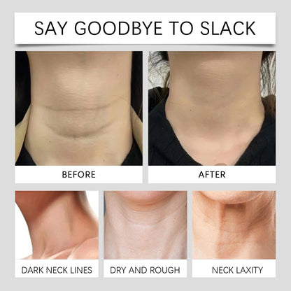 Youthful Neck Strips